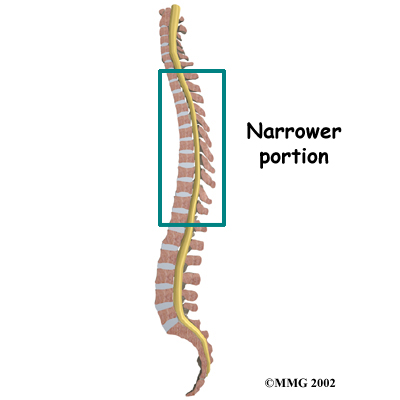 Thoracic Spine Anatomy - Narrow Spinal Canal