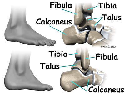 Ankle Bones