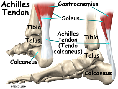 Achilles Tendon